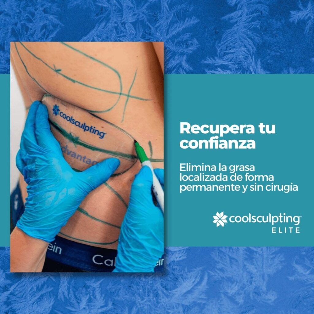 facebook ads coolsculpting